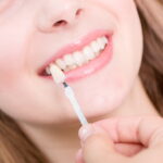 מה הקשר בין כתר לשיניים והשתלת שיניים